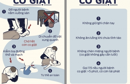 Kỹ năng sơ cứu cơ bản: Sơ cứu khi bị co giật